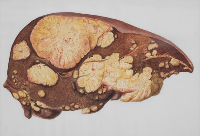 Comment détoxifier son foie naturellement ?